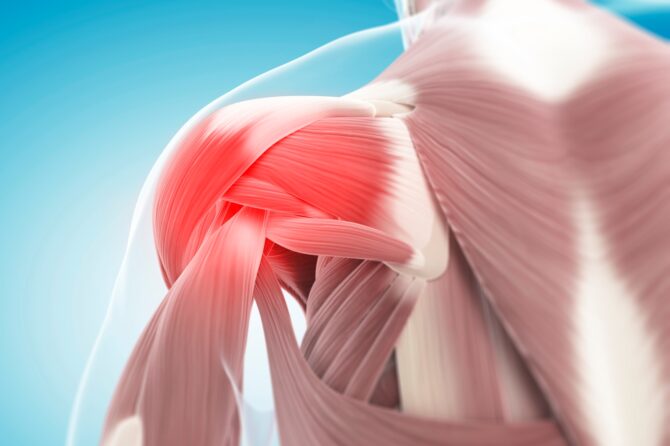 Povrede rotatorne manžetne ramena