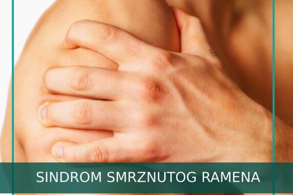 Sindrom smrznutog ramena